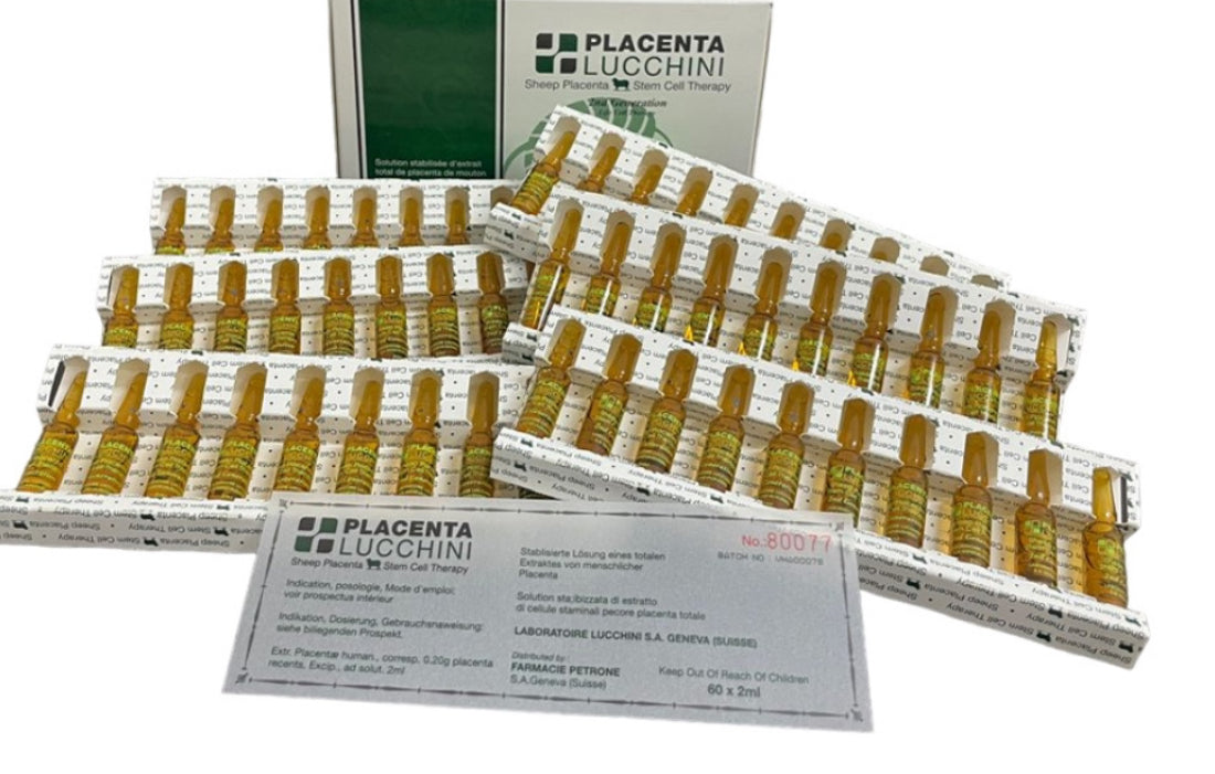 Placenta lucchini