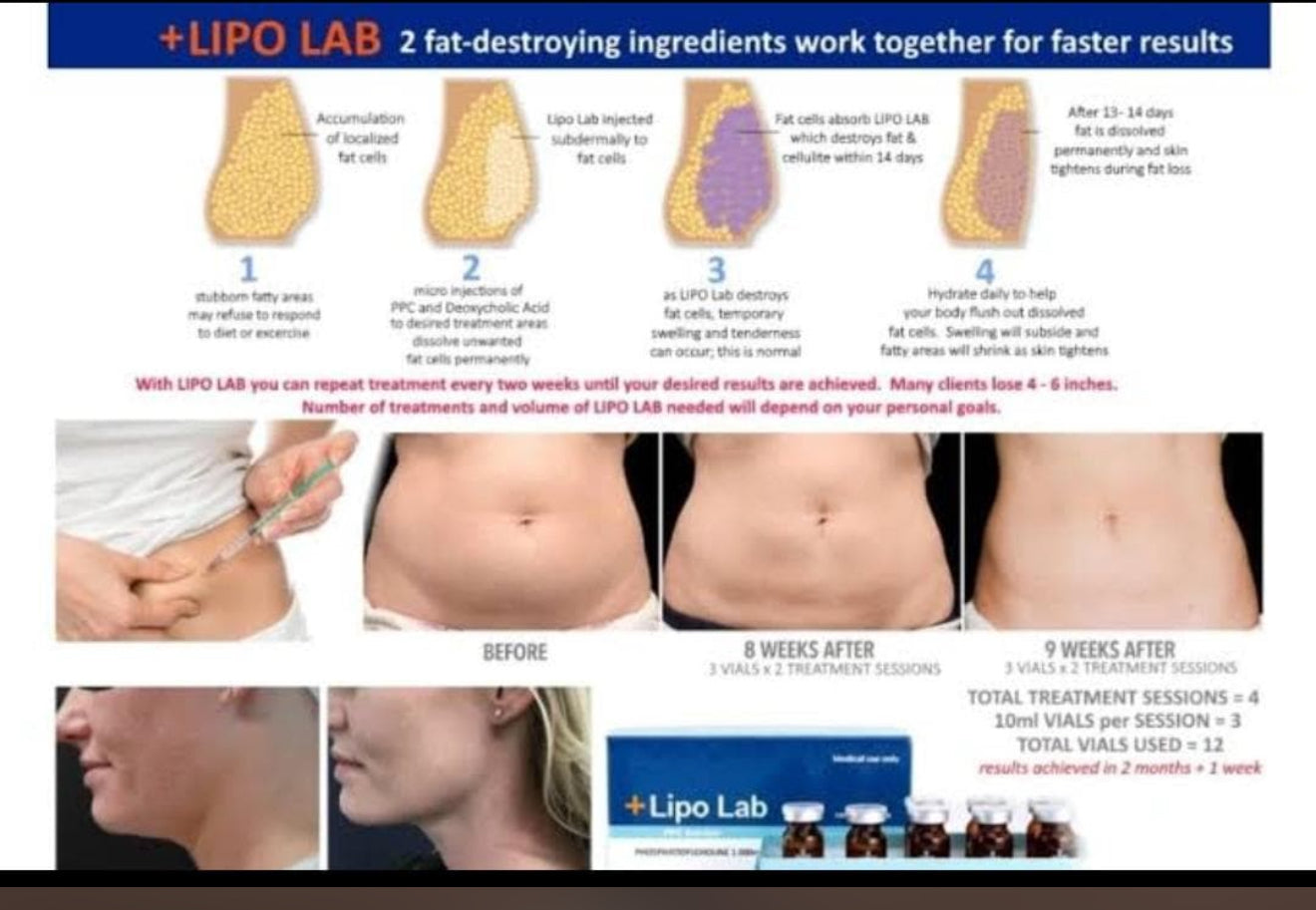Lipo lab